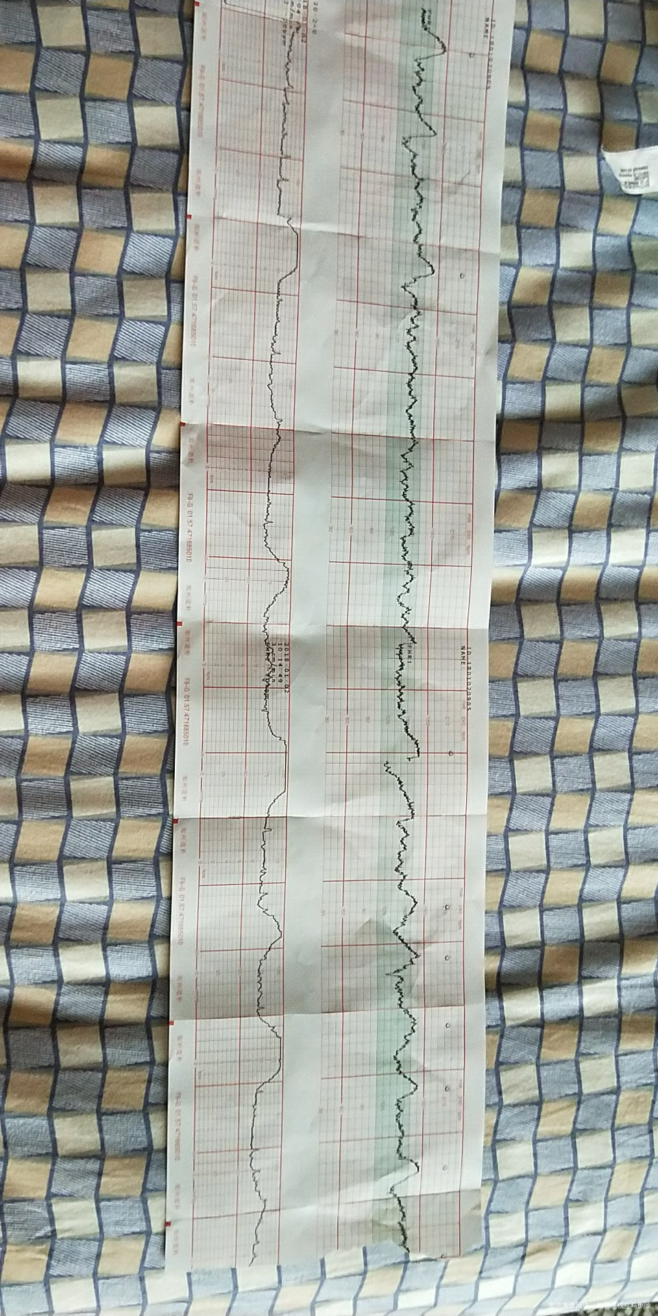 请医生帮忙看看这单子啥意思啊,非常感谢