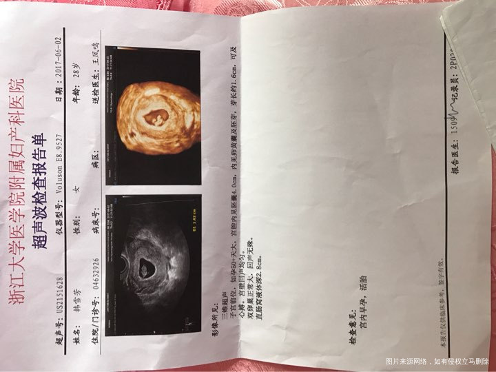 请在线的医生或是有经验的姐妹们帮我看看!