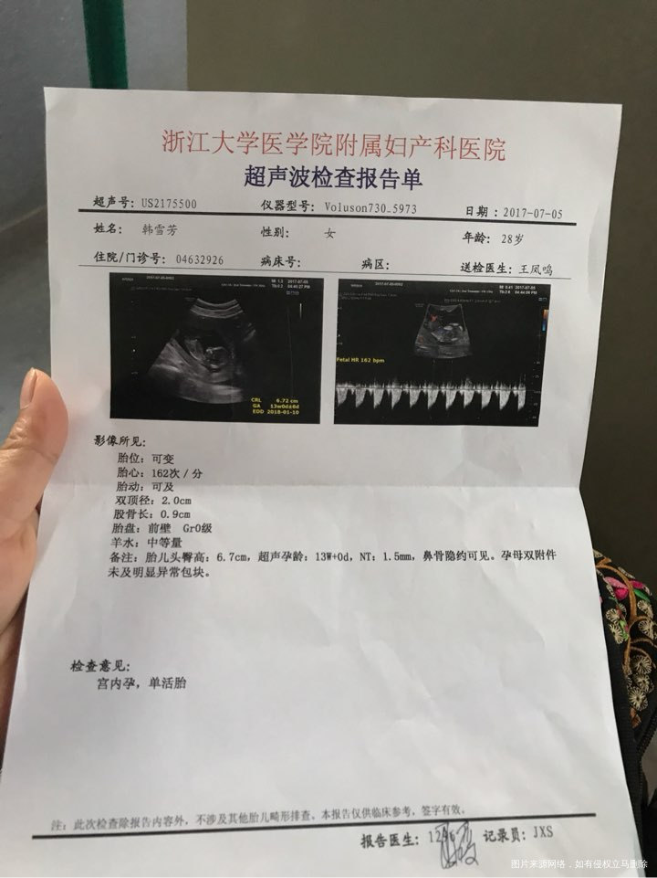 孕13周NT检查结果