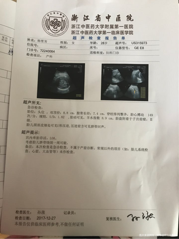 请好孕帮有经验的宝妈们帮我看看