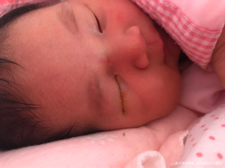 请医生、或有经验的宝妈帮忙看一下!谢谢🙏