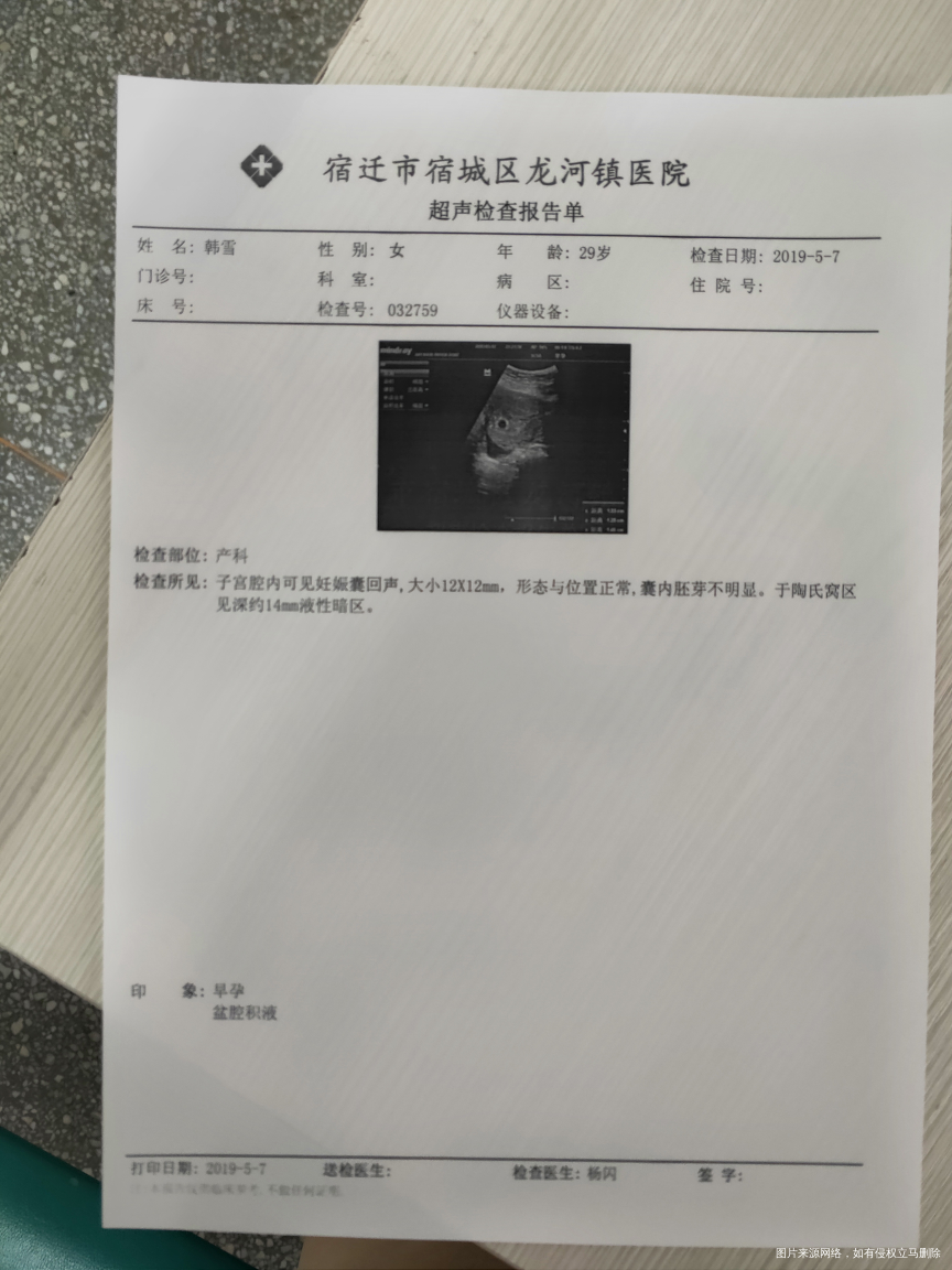 剖腹产一年又意外怀孕!