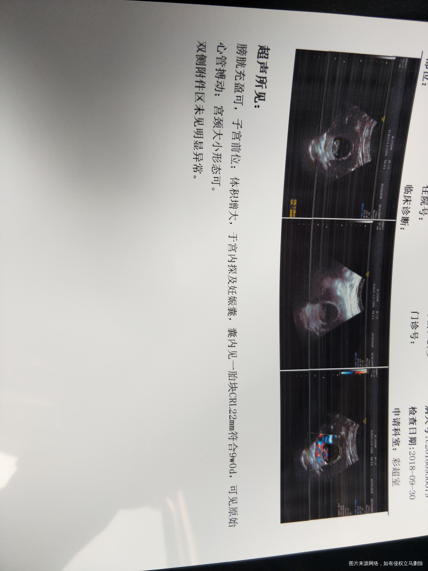 请问符合我的天数吗?末次是