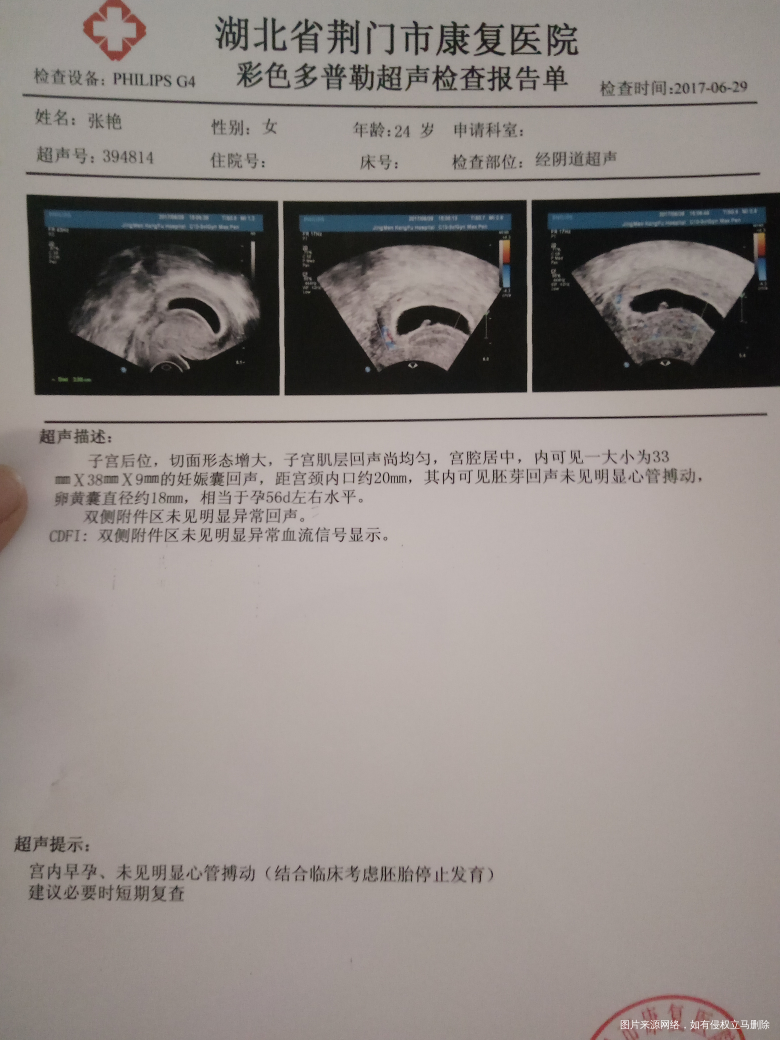 难受,我该怎么办?真的没办法啦?