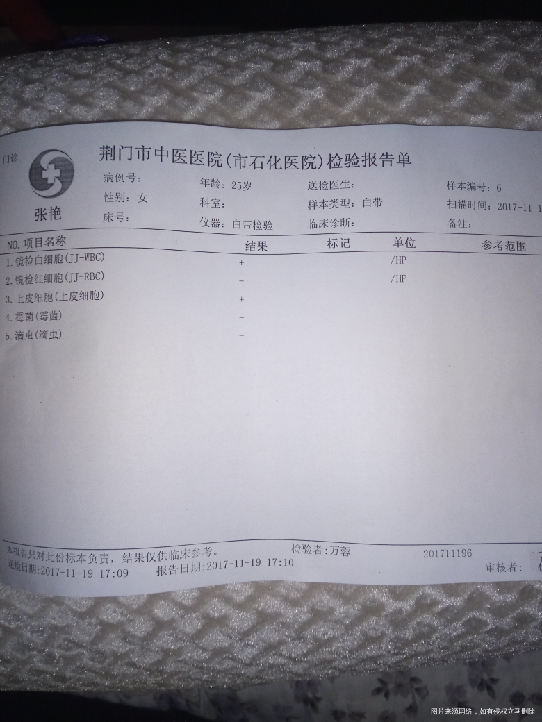 白带检查,请医生帮我看看,谢谢