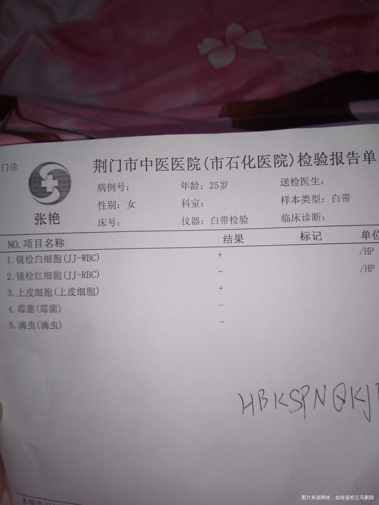 白带检查,请医生帮我看看