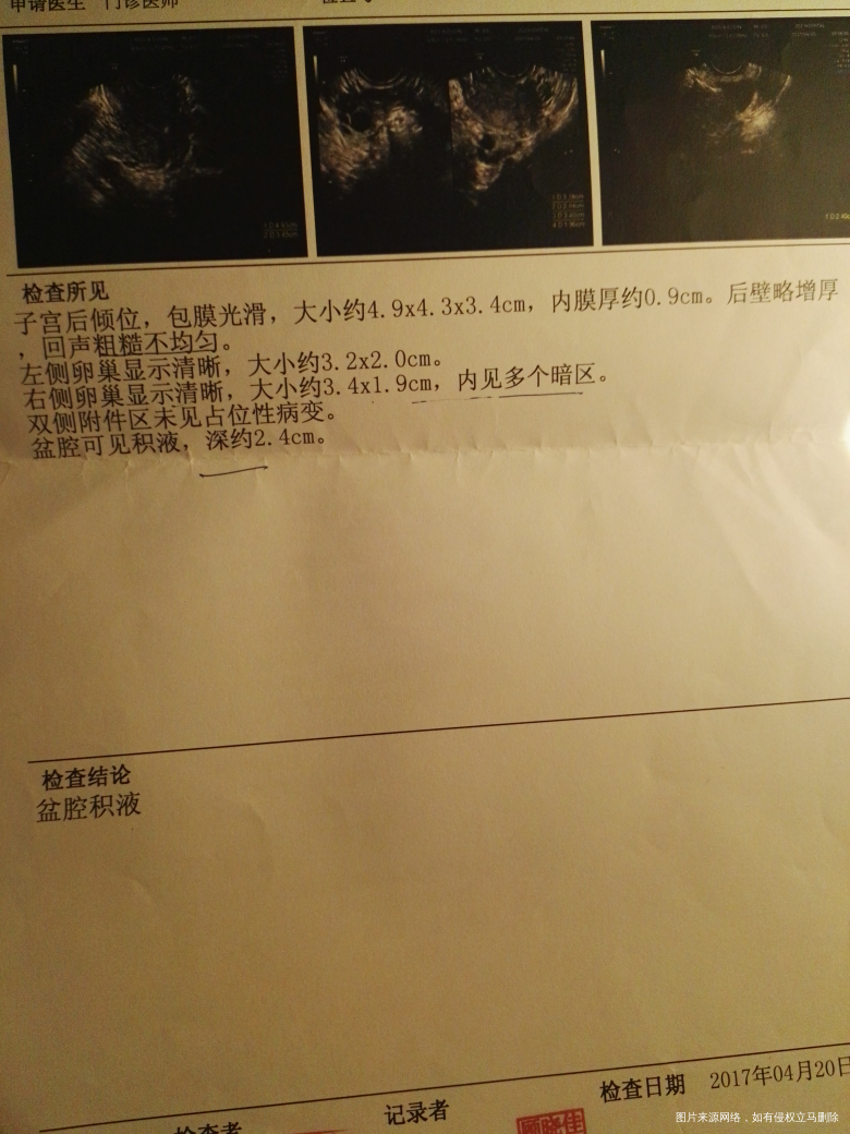 想找医生帮我看看这这B超结果有什么问题吗?