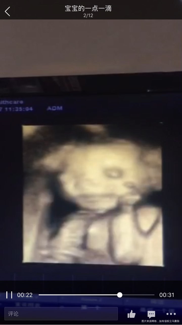 至我最【亲爱的宝贝】你好,