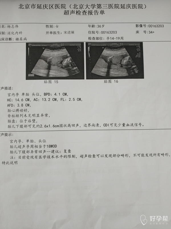 怀孕18周b超有点问题怎么办?