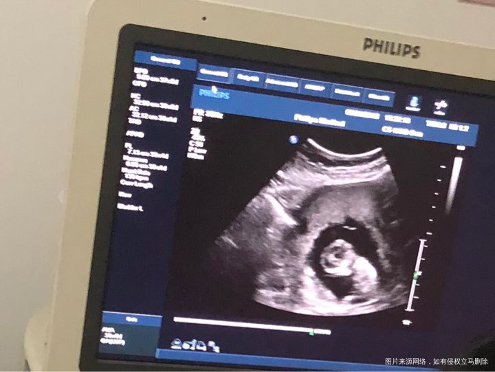 一次成功,12周,NT顺利通过