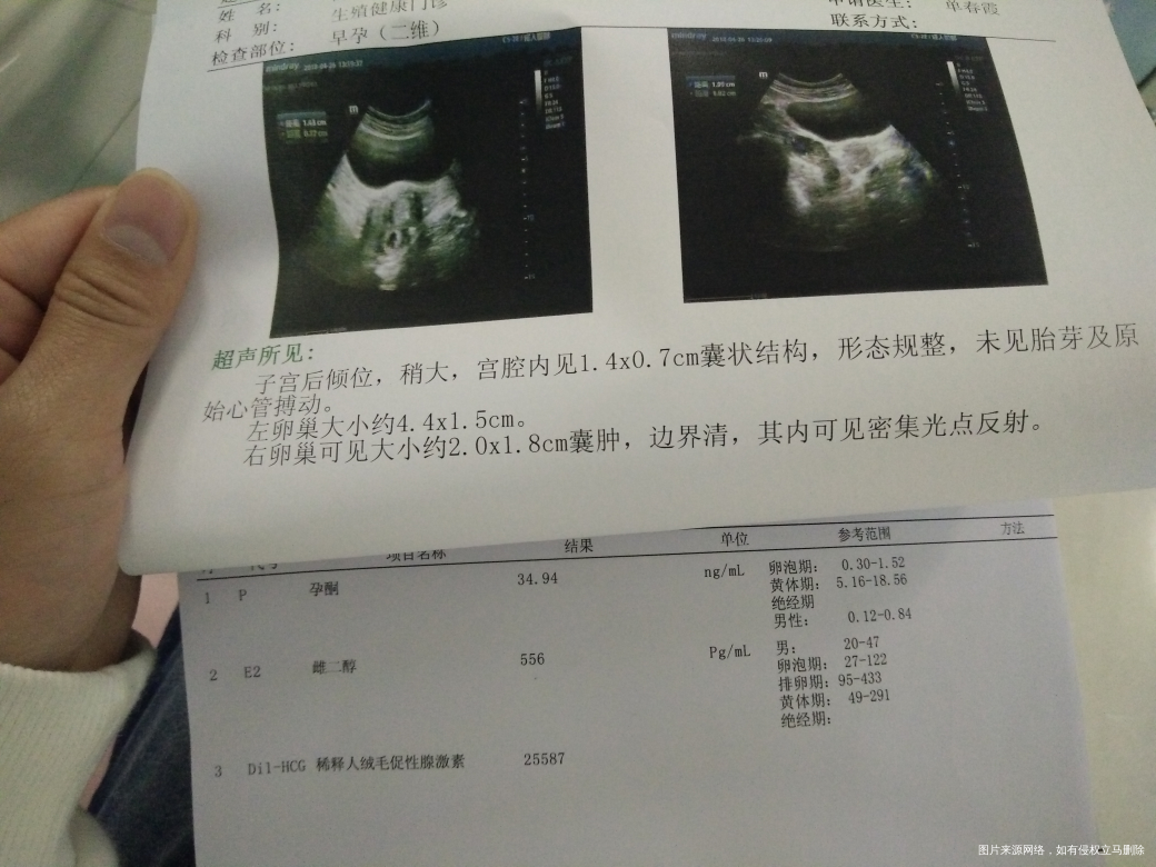求助医生孕6周+3没有胎芽胎心怎么办?