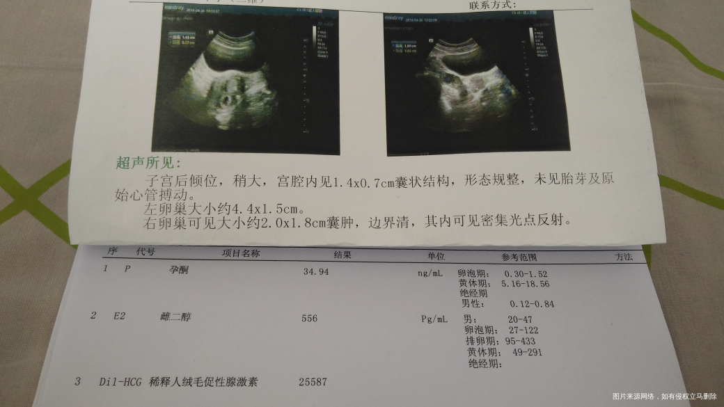 求助医生保住我这胎,孕检绒毛翻倍及彩超