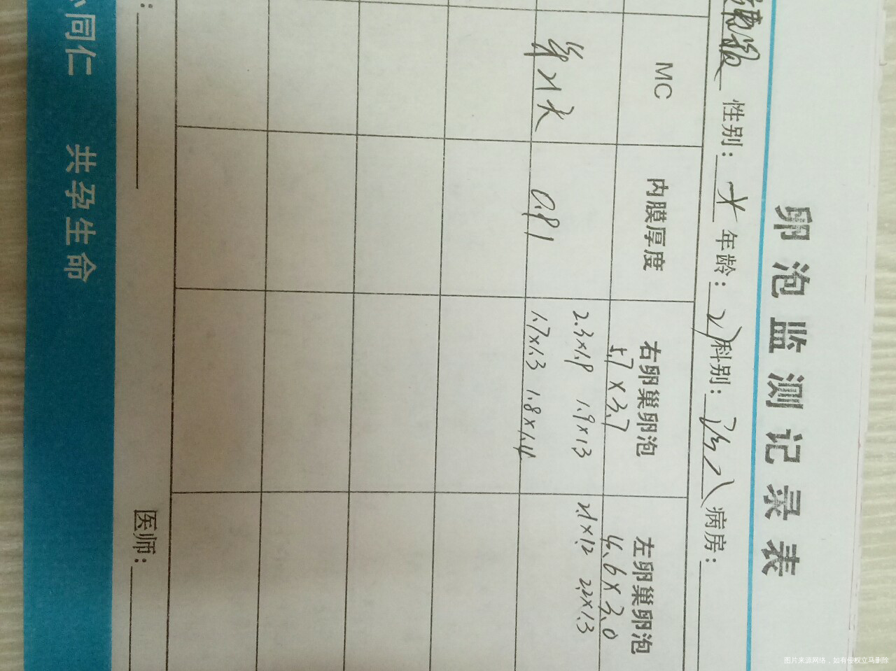 多囊卵巢不排卵穿刺手术