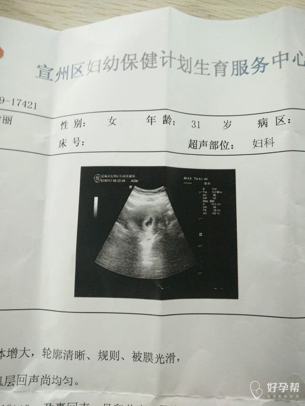 15,到今天54天,做b超说才三十多天,说孕囊欠饱满,帮忙给看一下有问题