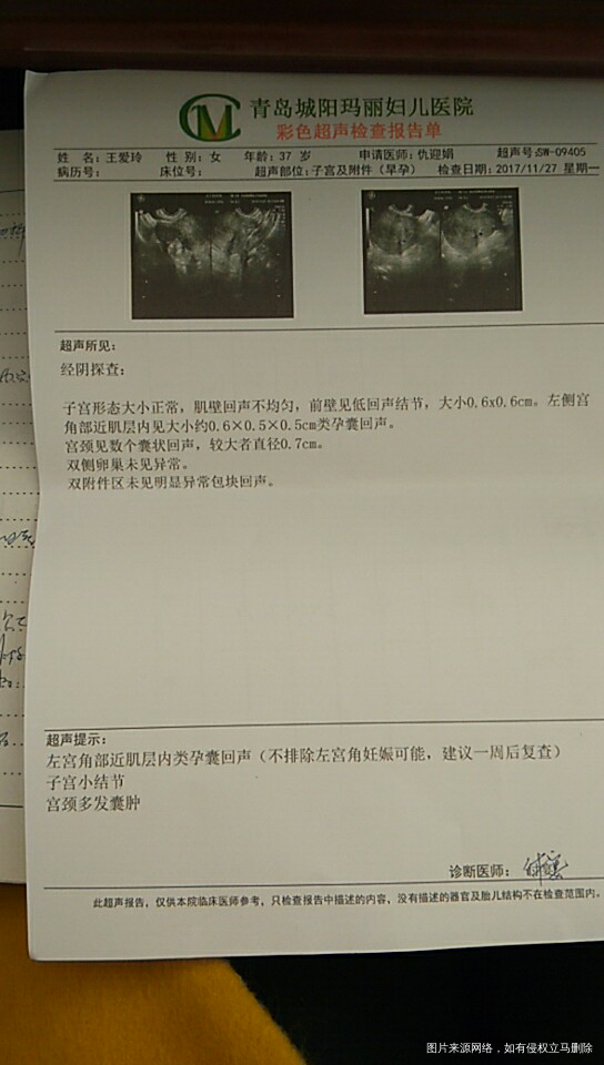 急急急今天42天B超说孕囊位置不好,咋办啊