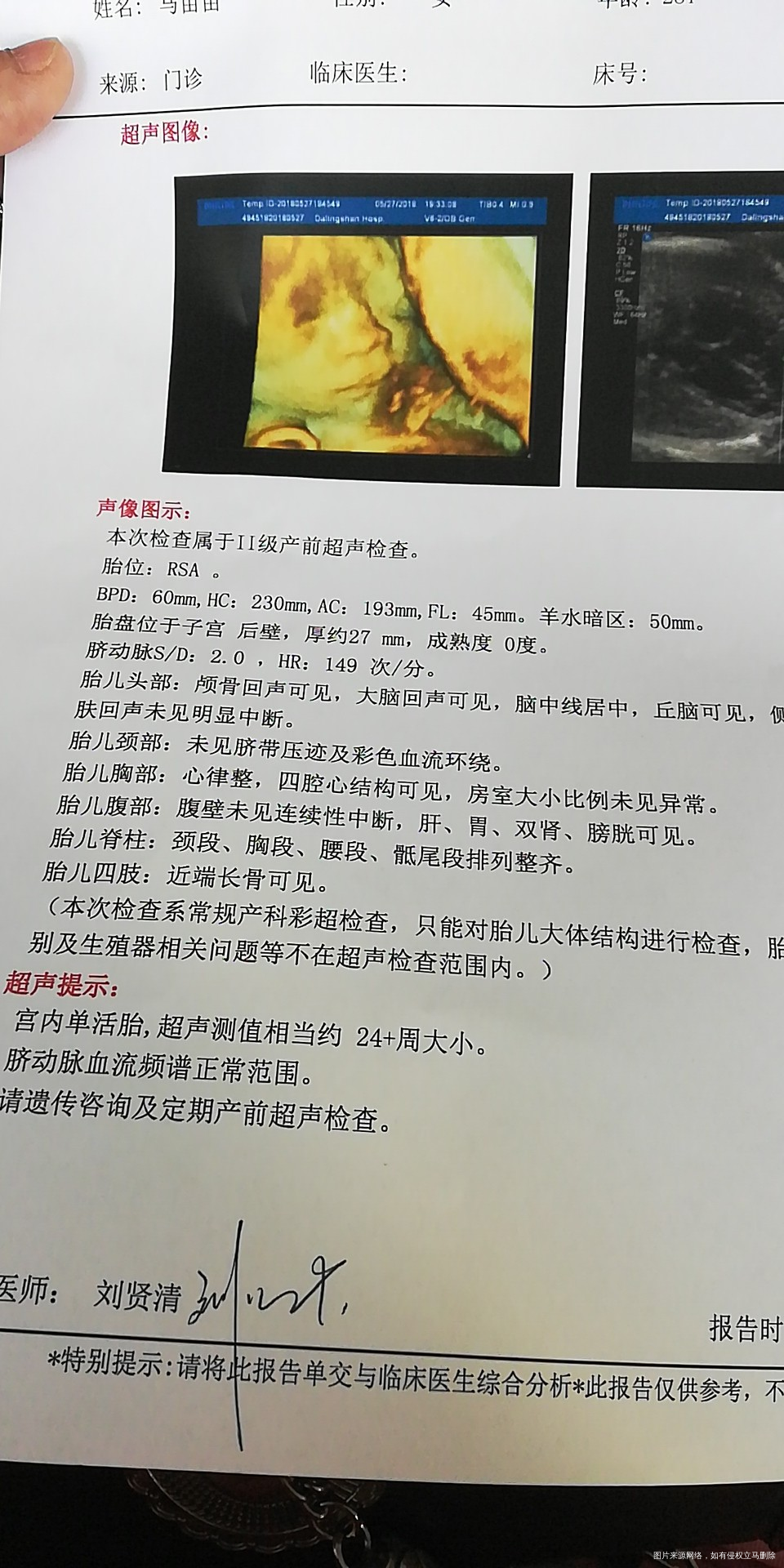 请医生帮忙解答一下,看看宝宝多重了,