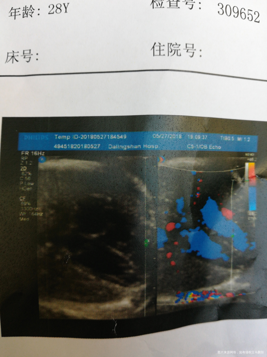 请医生帮忙解答一下,看看宝宝多重了,