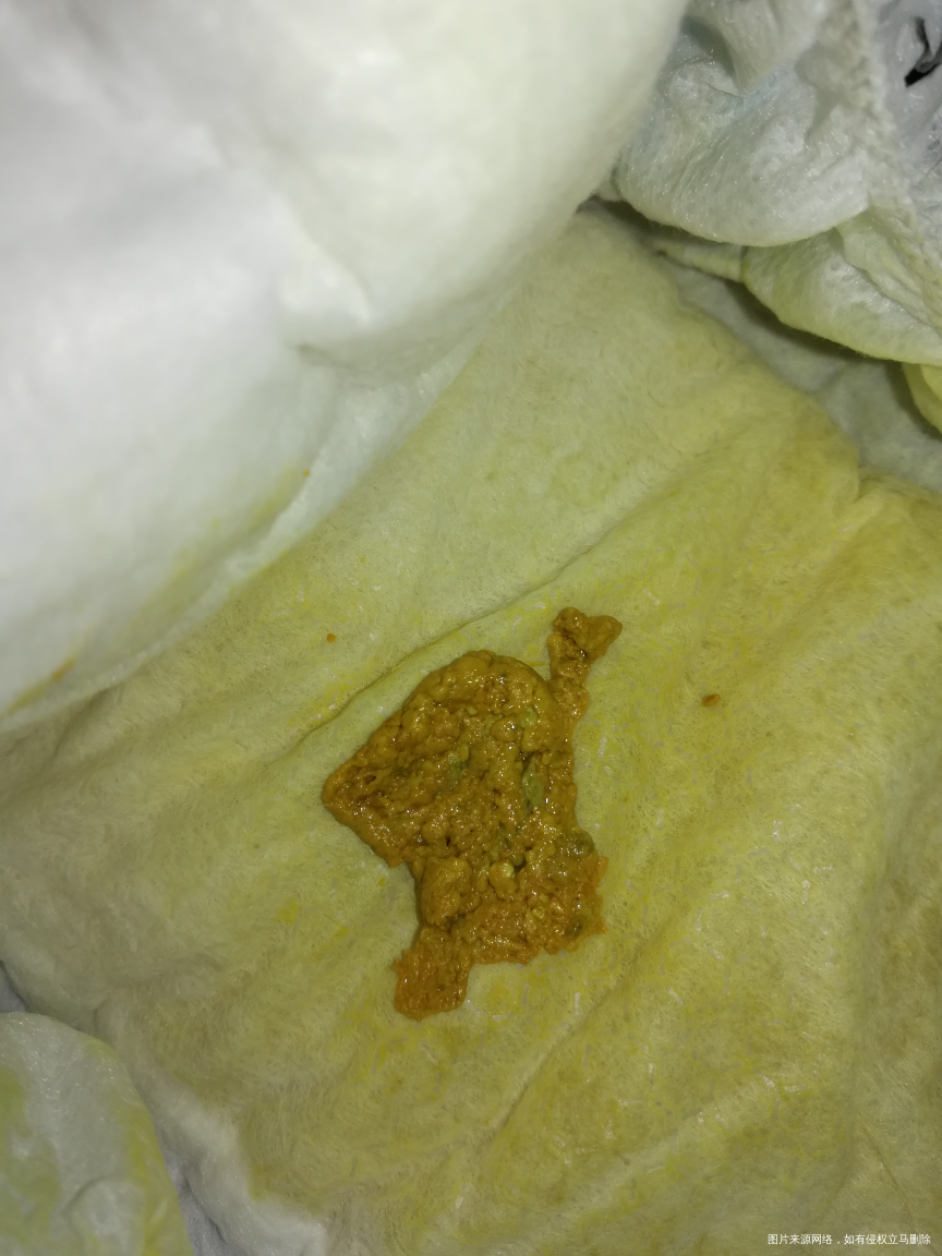 26号出生的宝宝。医生看看大便正常吗?