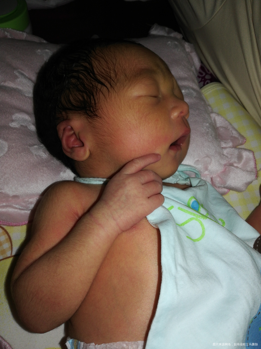 26号出生的宝宝。医生看看大便正常吗?