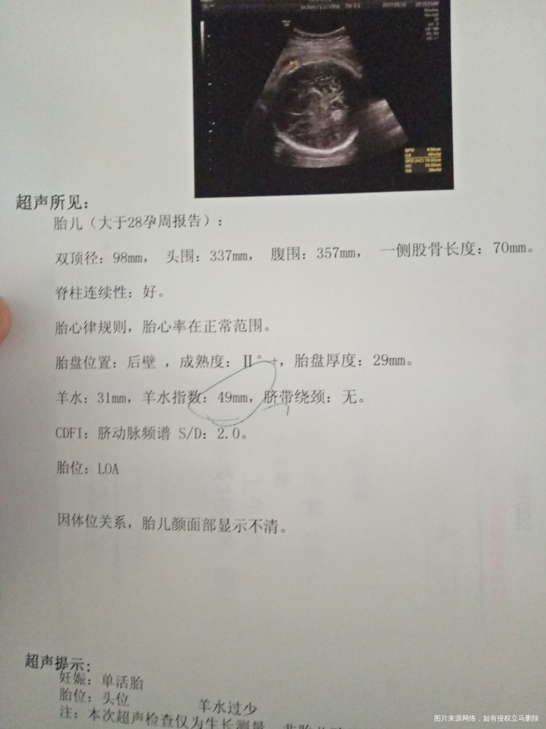 38周了羊水过少可以提前生了