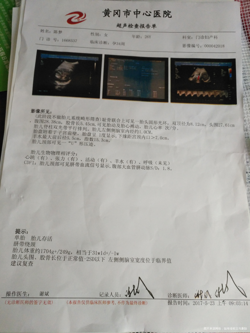 麻烦各位医生帮忙看一下,我这是不是很严重,