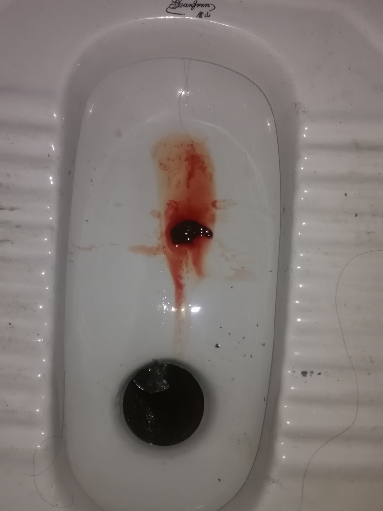肚子还不疼呢,上厕所突然掉一坨血下来.