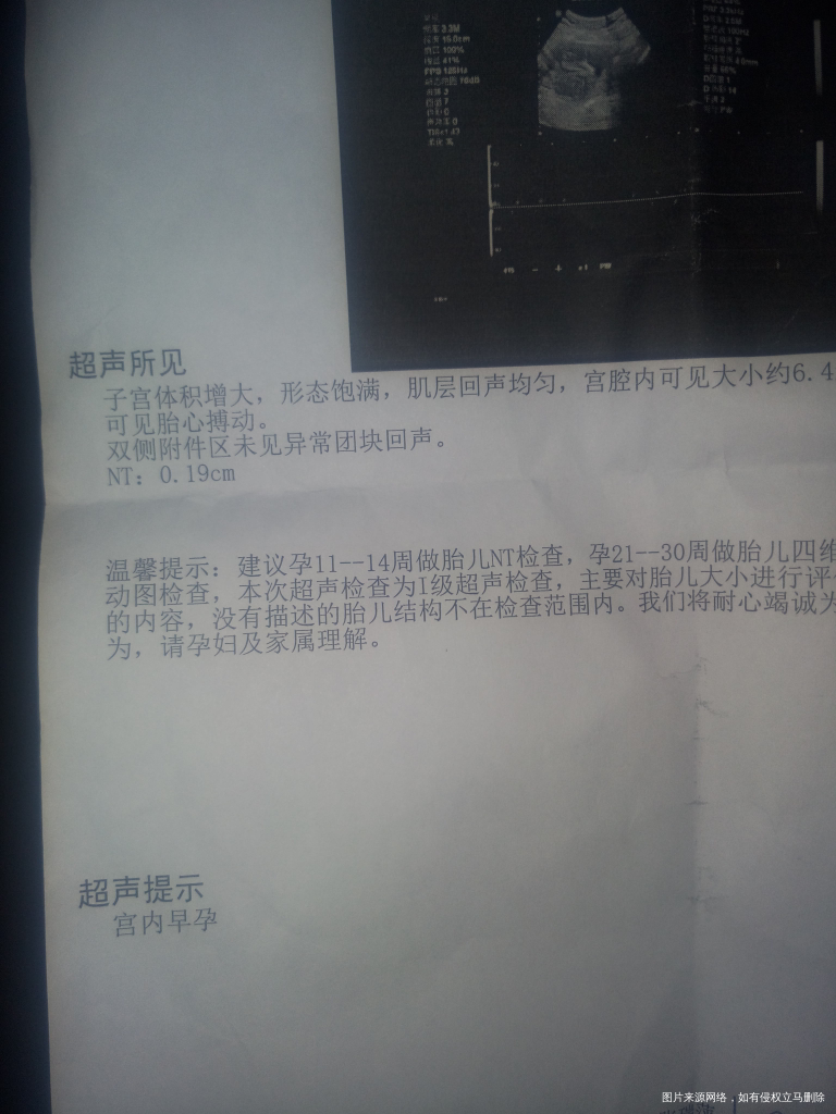 问问医生!
这个NT是什么,医生说挺好,昨天做的医院人多就没有详细问!就问问咱们…