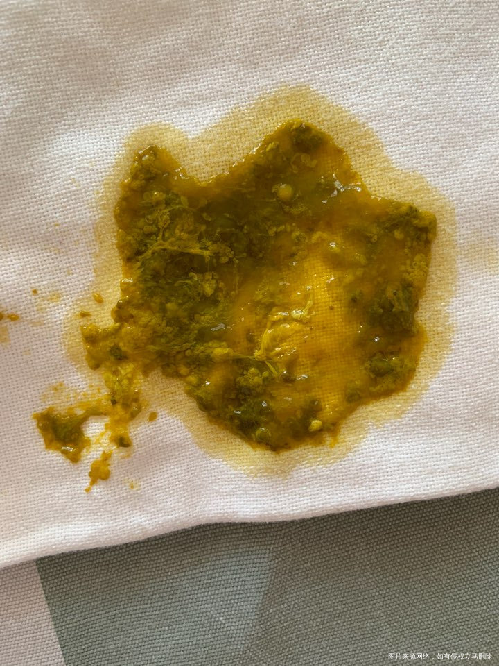 各位医生帮忙看看,谢谢了。