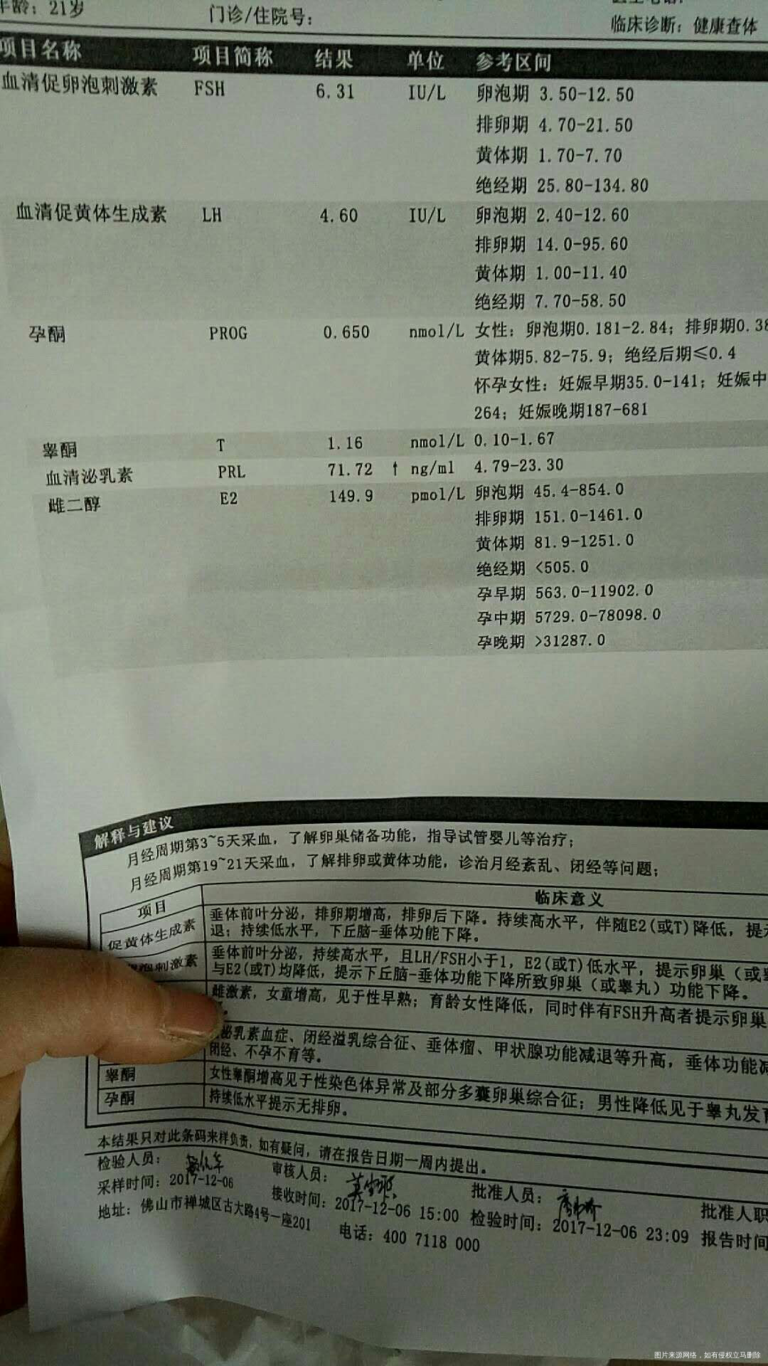 求助姐妹们,有没有人检查,必乳素高的,