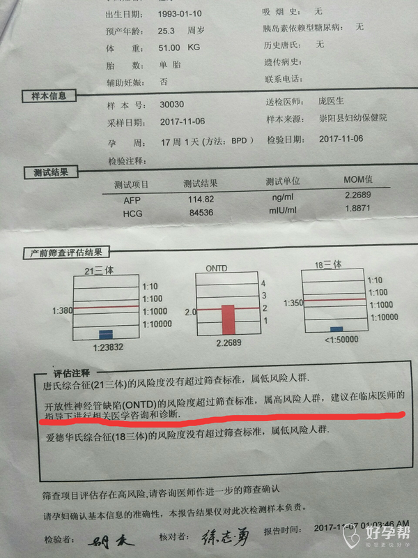 孕4个月唐氏筛查结果单