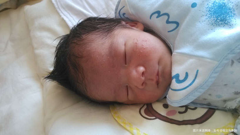 【辣妈经验】宝宝的皮肤护理