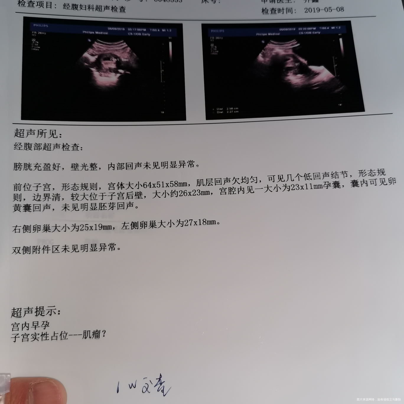 姐妹妹帮忙看下这正常吗