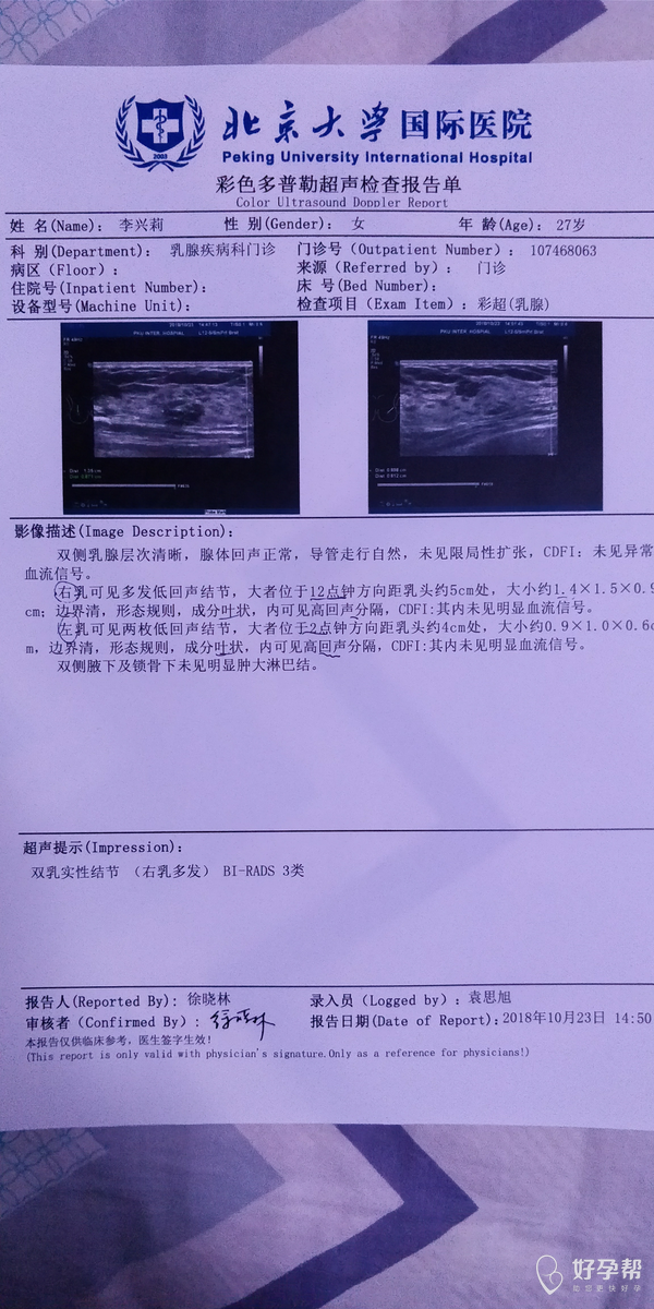 乳腺结节可以做试管吗