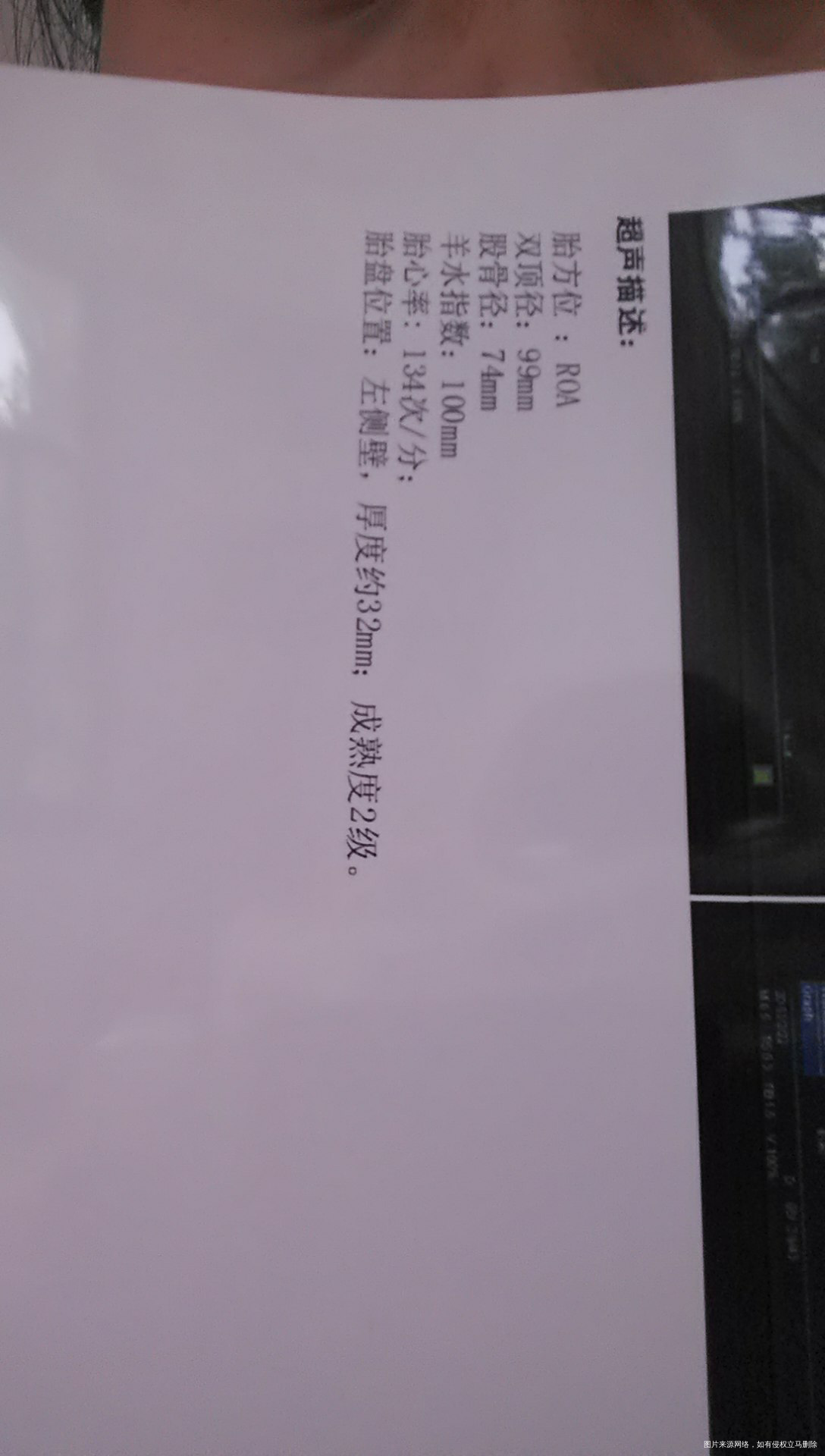 求助医生,想请问一下长期半入盆会不会对胎儿不好啊?