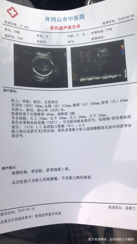 试管宝宝34周,能不能等到37周在发动啊