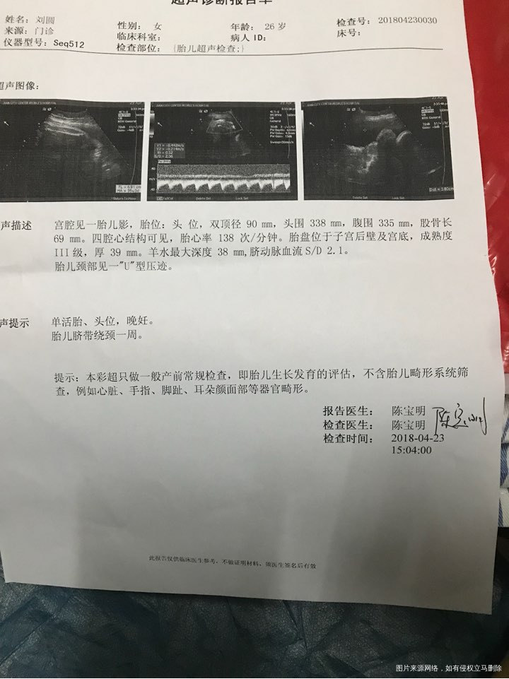 35周+2宝宝好像要提前了,