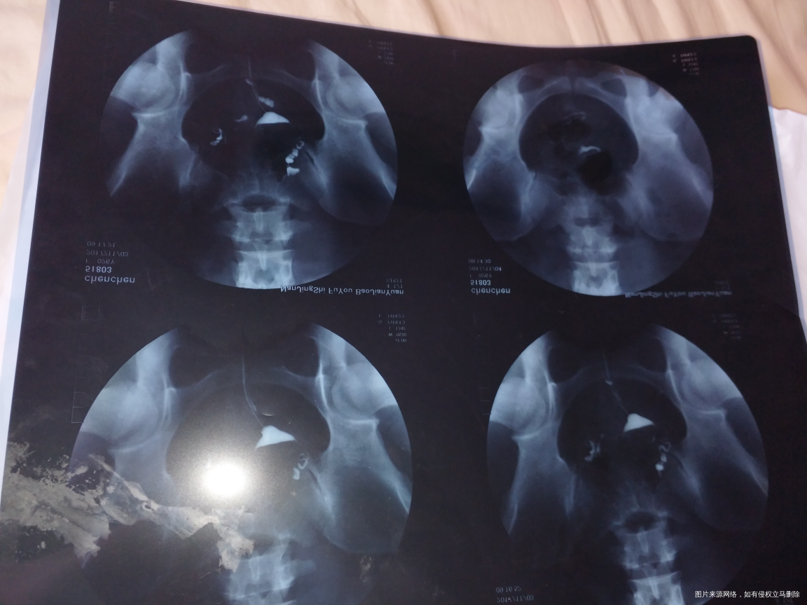 排卵后11天就来了,医生帮我看看怎么回事