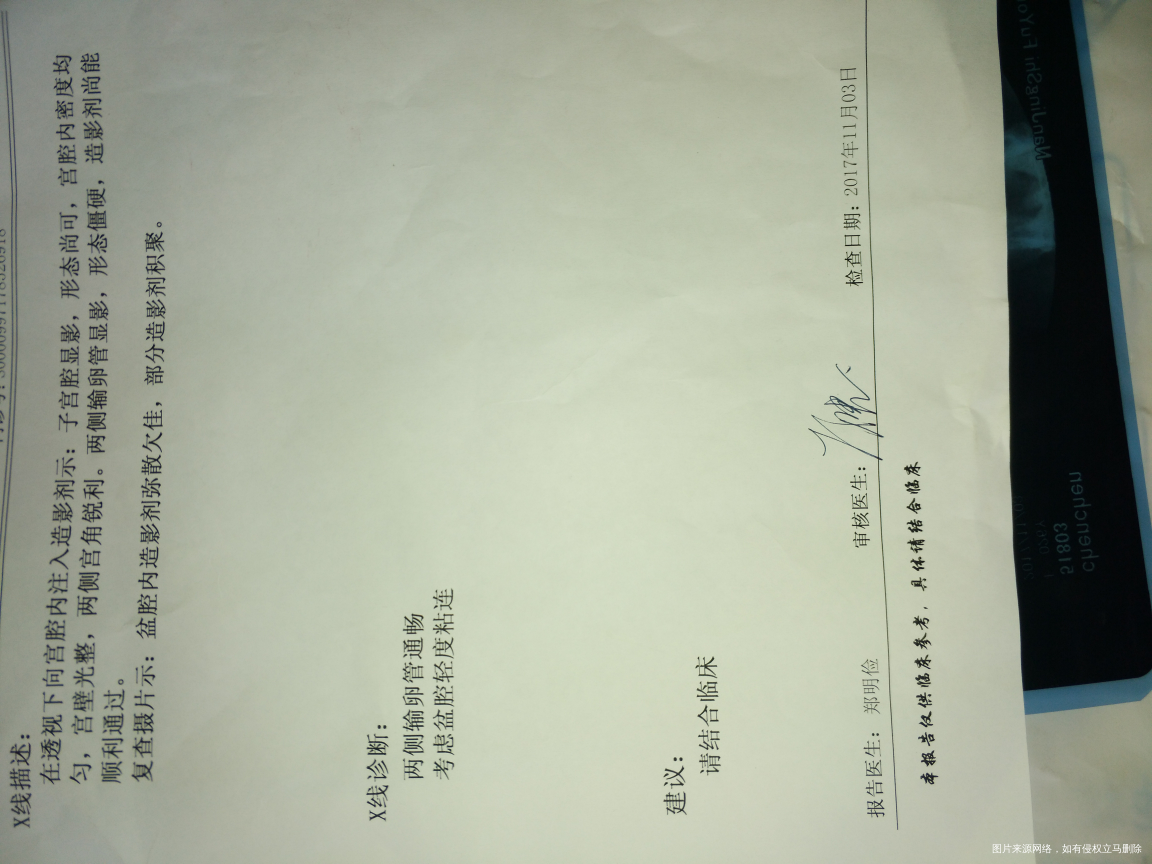 排卵后11天就来了,医生帮我看看怎么回事