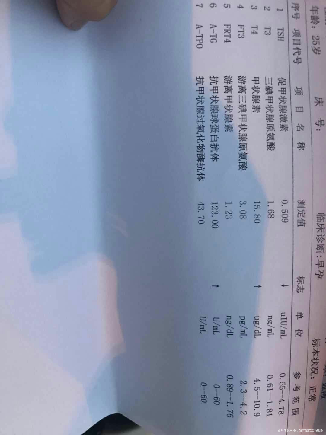 请医生帮忙看下报告,双胎孕9周,抗甲状腺素蛋白球很高,对孩子有影响吗?