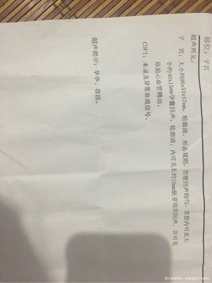 怀孕53天的单子……好好奇