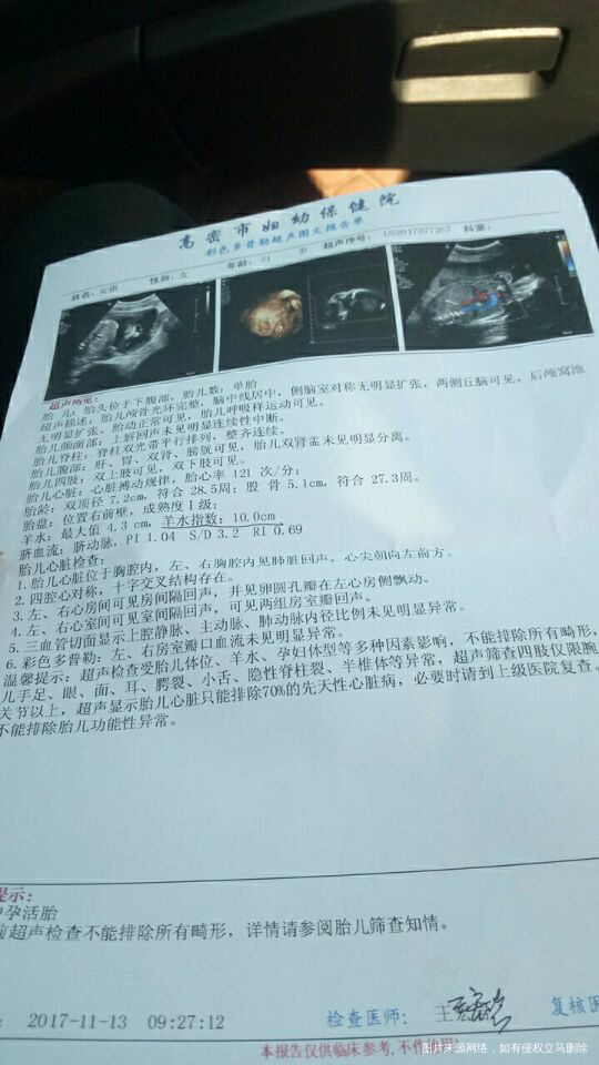 四维彩超顺利通过 猜猜男女吧