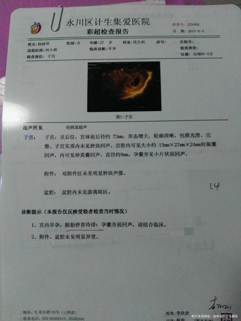 怀孕两月左右,检查没有胎心,医生直接叫做清宫手术