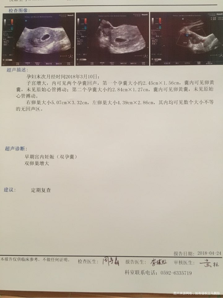 今天一超回来,还没有胚芽和心博,只见卵黄囊