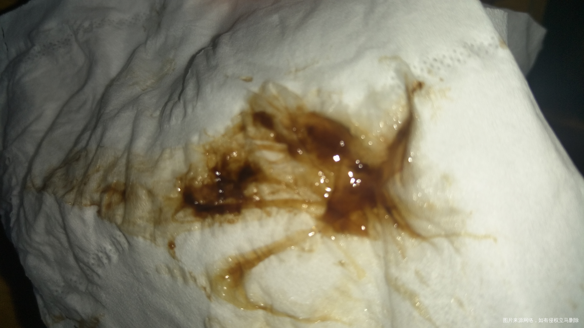 怀孕两个月多点昨天感觉浑身乏力很早就躺在床上夜里去厕所用纸巾擦拭有褐色分泌物,早...