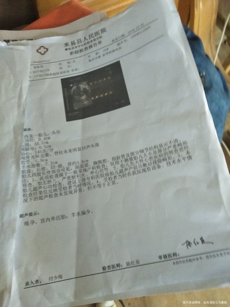 38周肚子微疼。流宫颈粘液。前天B超羊水少。