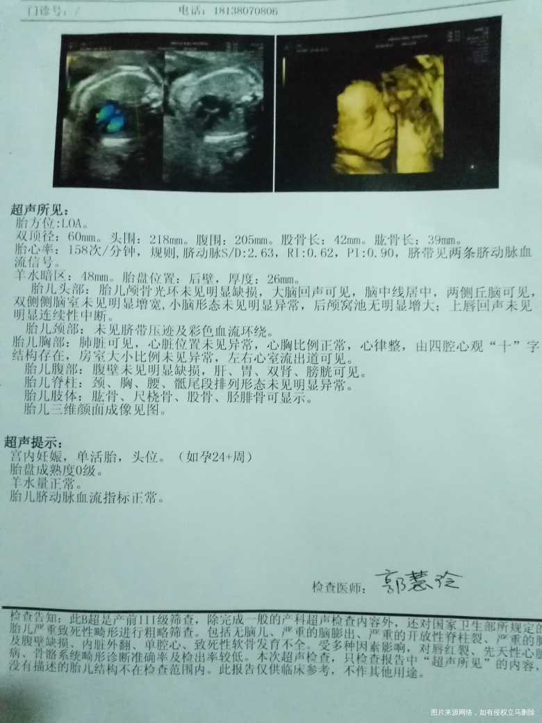 三维彩超,医生帮忙看看