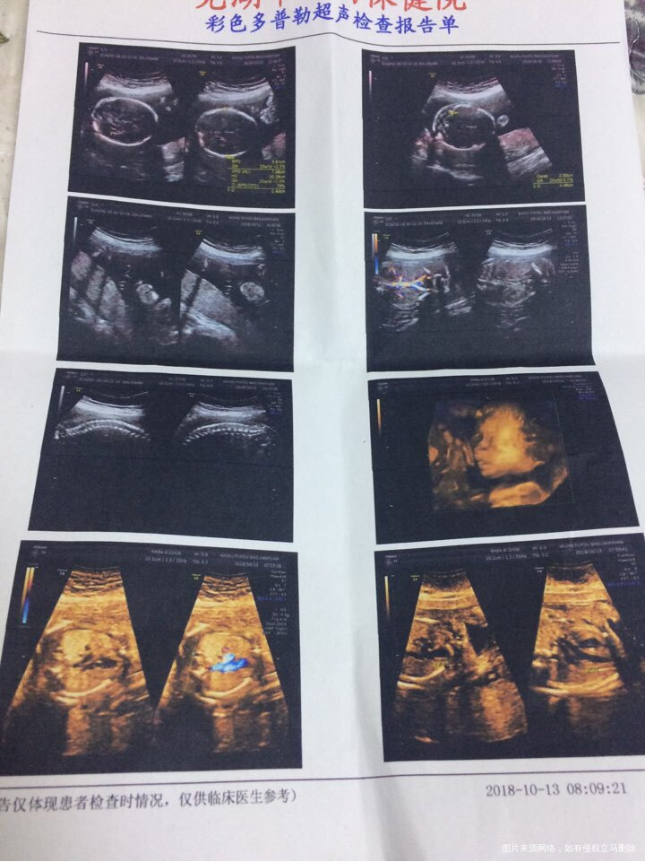 请大家帮忙看看这种情况正常吗?