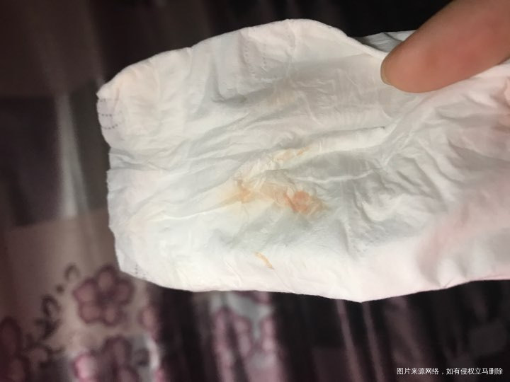 求助 隔三差五老有粉色血怎么办
