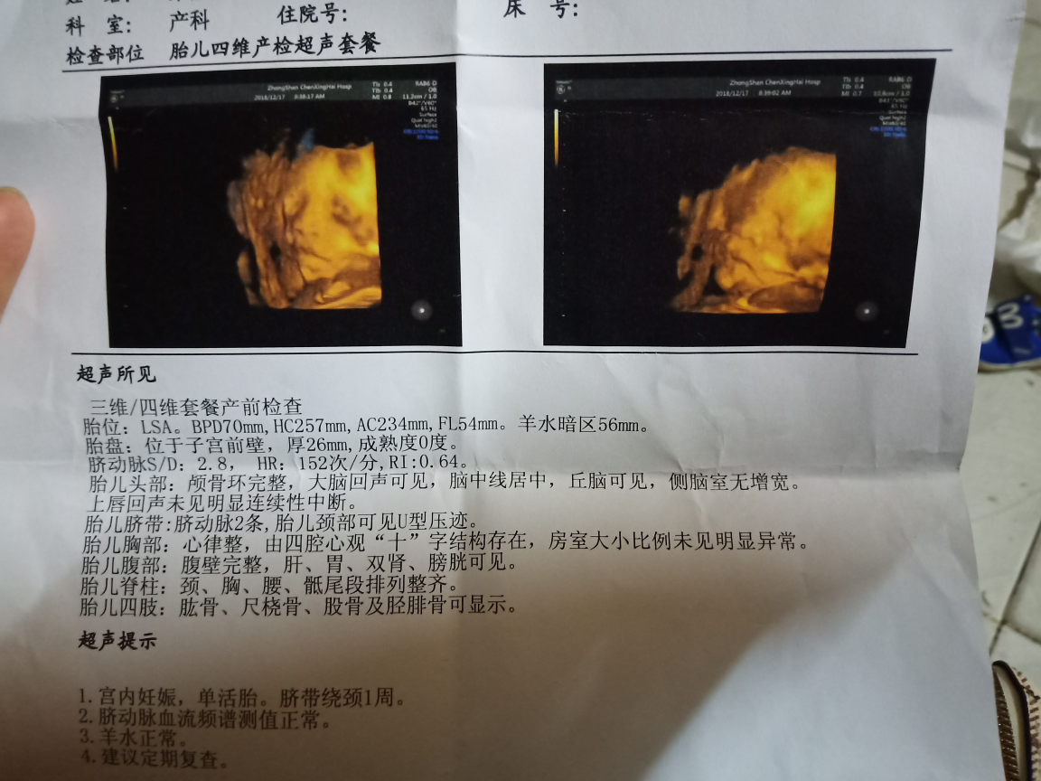 麻烦医生帮我看看这个四维，正常吗？