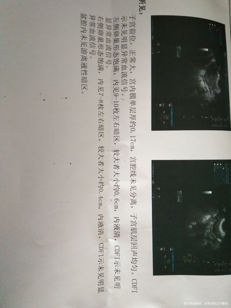 两边卵巢都是这种情况,怀孕还有戏吗